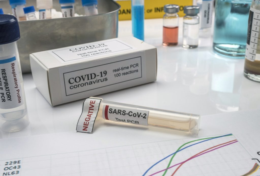 Novel coronavirus 2019 nCoV pcr diagnostics kit. This is RT-PCR kit